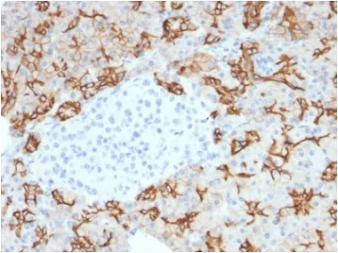Immunohistochemistry (Formalin/PFA-fixed paraffin-embedded sections) - Anti-TROP2 antibody [TACSTD2/2153] - BSA and Azide free (AB237861)