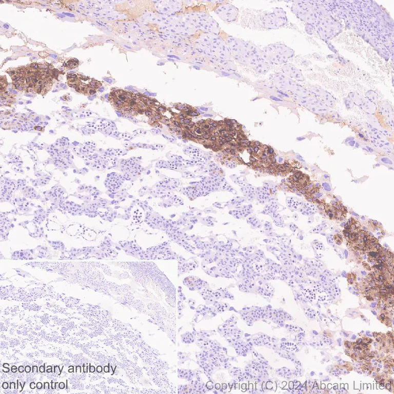 Immunohistochemistry (Formalin/PFA-fixed paraffin-embedded sections) - Anti-Trophoblast specific protein alpha antibody [EPR28905-557] (AB320823)