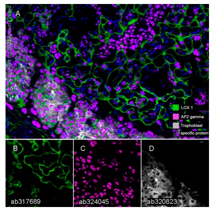 Multiplex immunohistochemistry - Anti-Trophoblast specific protein alpha antibody [EPR28905-557] (AB320823)