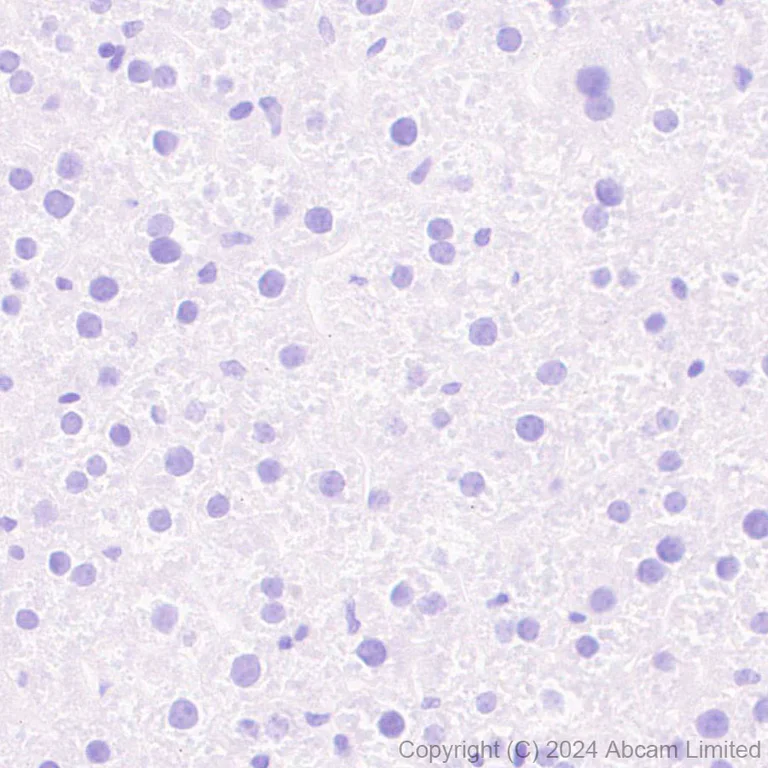 Immunohistochemistry (Formalin/PFA-fixed paraffin-embedded sections) - Anti-Trophoblast specific protein alpha antibody [EPR28905-557] - BSA and Azide free (AB320824)