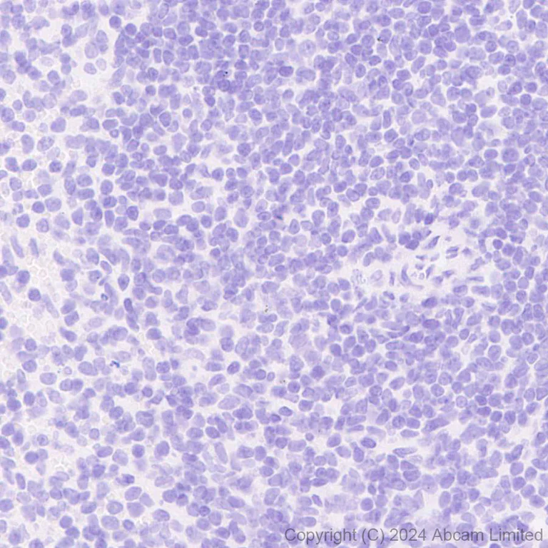 Immunohistochemistry (Formalin/PFA-fixed paraffin-embedded sections) - Anti-Trophoblast specific protein alpha antibody [EPR28905-557] - BSA and Azide free (AB320824)