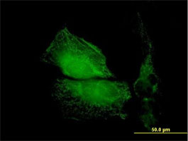 Immunocytochemistry/ Immunofluorescence - Anti-Tropomodulin 1 antibody (AB88608)