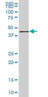 Western blot - Anti-Tropomodulin 1 antibody (AB88608)