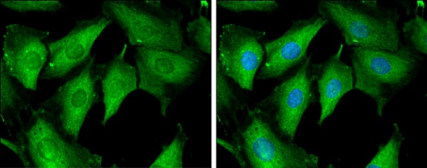 Immunocytochemistry/ Immunofluorescence - Anti-Tropomodulin 1 antibody - C-terminal (AB229679), expandable thumbnail