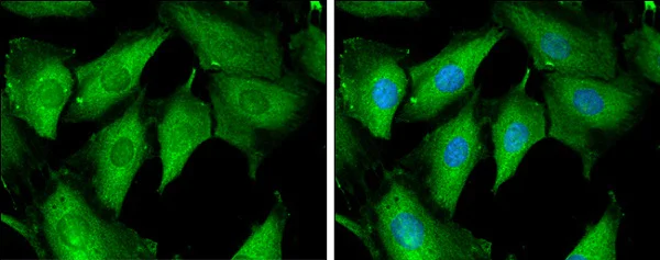 Immunocytochemistry/ Immunofluorescence - Anti-Tropomodulin 1 antibody - C-terminal (AB229679)