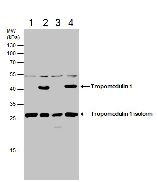 Western blot - Anti-Tropomodulin 1 antibody - C-terminal (AB229679), expandable thumbnail