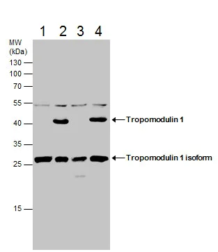 Western blot - Anti-Tropomodulin 1 antibody - C-terminal (AB229679)