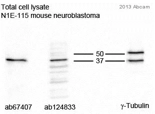 Western blot - Anti-Tropomodulin 2 antibody (AB67407)
