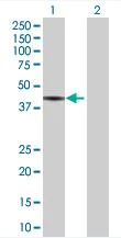 Western blot - Anti-Tropomodulin 2 antibody (AB67407)