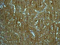 Immunohistochemistry (Formalin/PFA-fixed paraffin-embedded sections) - Anti-Tropomodulin 2 antibody [EPR6353] (AB124833)