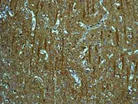Immunohistochemistry (Formalin/PFA-fixed paraffin-embedded sections) - Anti-Tropomodulin 2 antibody [EPR6353] - BSA and Azide free (AB248026)