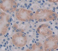 Immunohistochemistry (Formalin/PFA-fixed paraffin-embedded sections) - Anti-Tropomodulin 3 antibody (AB232946)