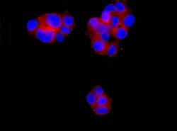 Immunocytochemistry/ Immunofluorescence - Anti-Tropomodulin 3 antibody [EPR10302(B)] (AB155968)