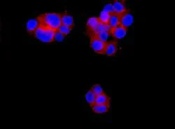 Immunocytochemistry/ Immunofluorescence - Anti-Tropomodulin 3 antibody [EPR10302(B)] (AB155968)