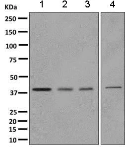 Western blot - Anti-Tropomodulin 3 antibody [EPR10303(B)] (AB157215)