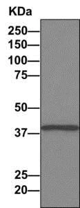 Western blot - Anti-Tropomodulin 3 antibody [EPR10303(B)] (AB157215)