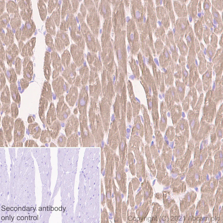 Immunohistochemistry (Formalin/PFA-fixed paraffin-embedded sections) - Anti-Tropomyosin 1 (alpha) antibody [EPR5158] - BSA and Azide free (AB247885)