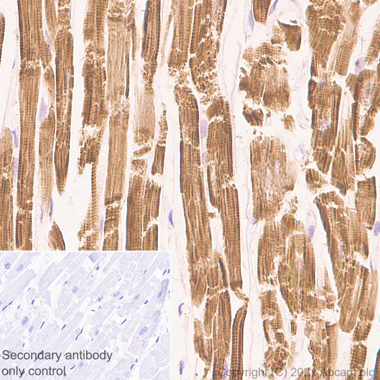 Immunohistochemistry (Formalin/PFA-fixed paraffin-embedded sections) - Anti-Tropomyosin 1 (alpha) antibody [EPR5158] - BSA and Azide free (AB247885)