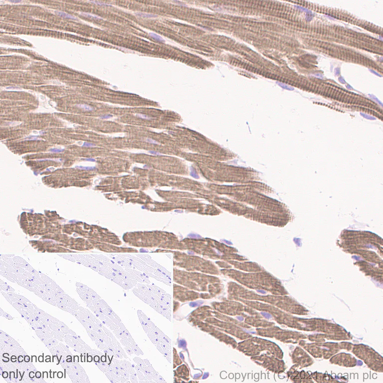 Immunohistochemistry (Formalin/PFA-fixed paraffin-embedded sections) - Anti-Tropomyosin 1 (alpha) antibody [EPR5158] - BSA and Azide free (AB247885)