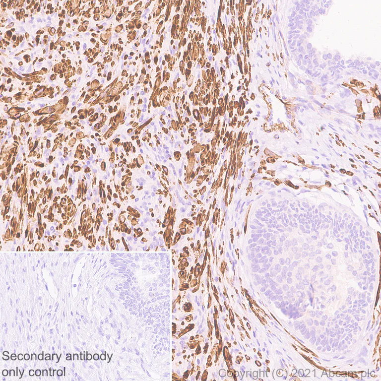 Immunohistochemistry (Formalin/PFA-fixed paraffin-embedded sections) - Anti-Tropomyosin 1 (alpha) antibody [EPR5158] - BSA and Azide free (AB247885)