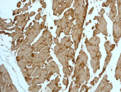 Immunohistochemistry (Formalin/PFA-fixed paraffin-embedded sections) - Anti-Tropomyosin 1 (alpha) + Tropomyosin 3 antibody [EPR5159] - BSA and Azide free (AB240056)