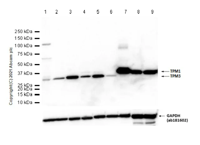 Western blot - Anti-Tropomyosin 1 (alpha) + Tropomyosin 3 antibody [EPR5159] - BSA and Azide free (AB240056)
