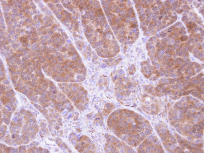 Immunohistochemistry (Formalin/PFA-fixed paraffin-embedded sections) - Anti-Tropomyosin 2 antibody (AB96073)