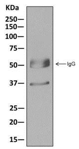 Immunoprecipitation - Anti-Tropomyosin 2 antibody [EPR12846] - BSA and Azide free (AB250178), expandable thumbnail