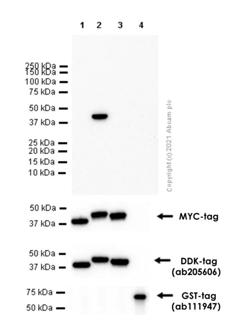 Western blot - Anti-Tropomyosin 2 antibody [EPR12846] - BSA and Azide free (AB250178)
