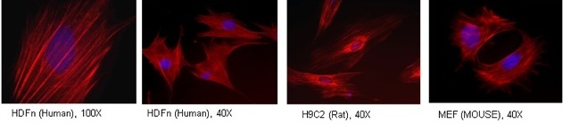 Immunocytochemistry/ Immunofluorescence - Anti-Tropomyosin 3 antibody [3D5AH3AB4] (AB113692)