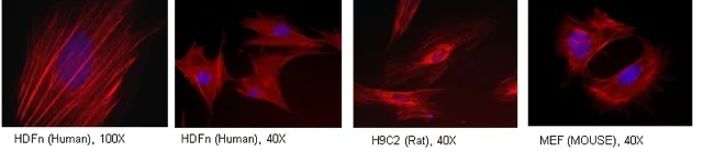 Immunocytochemistry/ Immunofluorescence - Anti-Tropomyosin 3 antibody [3D5AH3AB4] (AB113692)