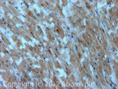 Immunohistochemistry (Formalin/PFA-fixed paraffin-embedded sections) - Anti-Tropomyosin 3 antibody [3D5AH3AB4] (AB113692)