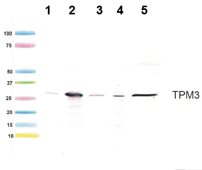 Western blot - Anti-Tropomyosin 3 antibody [3D5AH3AB4] (AB113692)