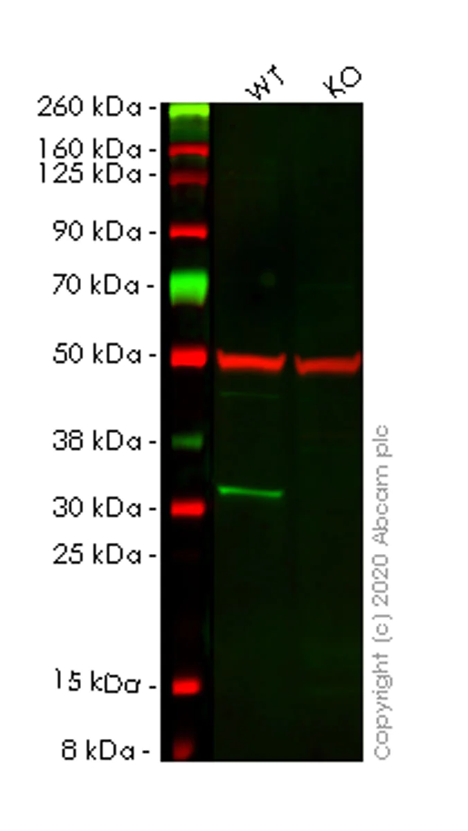 Western blot - Anti-Tropomyosin 3 antibody [3D5AH3AB4] (AB113692)