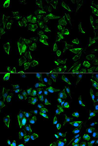 Immunocytochemistry/ Immunofluorescence - Anti-Tropomyosin 3 antibody (AB180813)