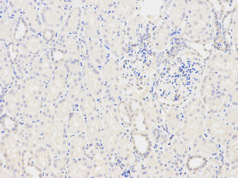 Immunohistochemistry (Formalin/PFA-fixed paraffin-embedded sections) - Anti-Tropomyosin 3 antibody (AB180813)
