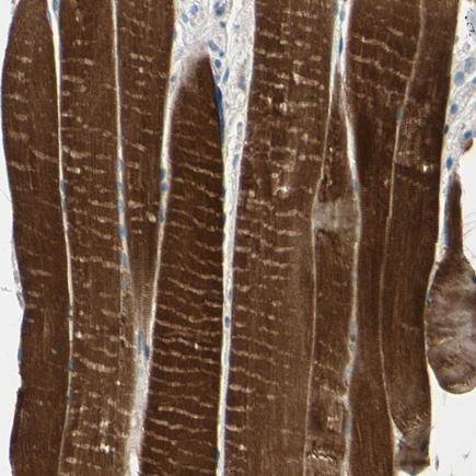 Immunohistochemistry (Formalin/PFA-fixed paraffin-embedded sections) - Anti-Tropomyosin 3 antibody (AB224355)