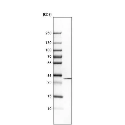 Western blot - Anti-Tropomyosin 3 antibody (AB224355)