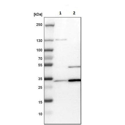 Western blot - Anti-Tropomyosin 3 antibody (AB224355)