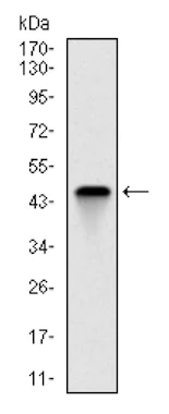 Western blot - Anti-Troponin I fast skeletal muscle antibody [2F12G2] (AB126824)