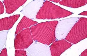 Immunohistochemistry (Formalin/PFA-fixed paraffin-embedded sections) - Anti-Troponin I fast skeletal muscle antibody (AB134838)