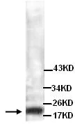 Western blot - Anti-Troponin I fast skeletal muscle antibody (AB134838)