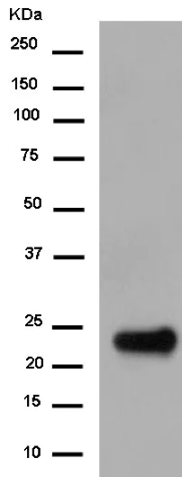 Western blot - Anti-Troponin I fast skeletal muscle antibody [EPR14926] - BSA and Azide free (AB190175)