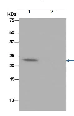 Immunoprecipitation - Anti-Troponin I fast skeletal muscle antibody [EPR14927(B)] (AB184554)