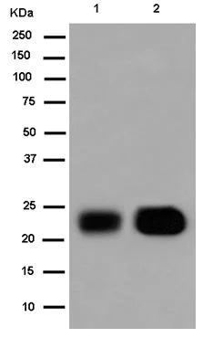 Western blot - Anti-Troponin I fast skeletal muscle antibody [EPR14927(B)] - BSA and Azide free (AB250756)