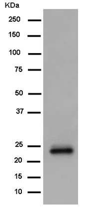 Western blot - Anti-Troponin I fast skeletal muscle antibody [EPR14927(B)] - BSA and Azide free (AB250756)