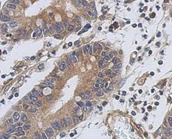 Immunohistochemistry (Formalin/PFA-fixed paraffin-embedded sections) - Anti-Troponin T1/TNT antibody (AB155028)