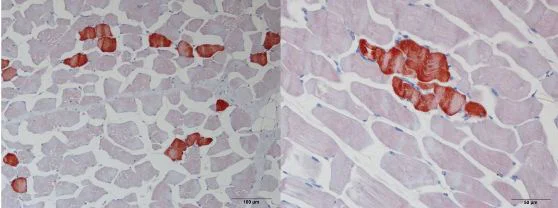 Immunohistochemistry (Formalin/PFA-fixed paraffin-embedded sections) - Anti-Troponin T1/TNT antibody (AB155028)
