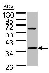 Western blot - Anti-Troponin T1/TNT antibody (AB155028)