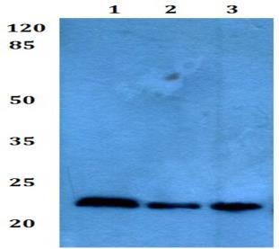 Western blot - Anti-Troponin T1/TNT antibody (AB193546)